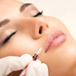 How Long Do Lip Injections Last After Fillers?